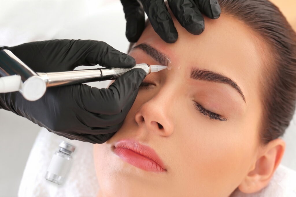 Szemöldök tetoválás eltávolítása lézerrel a debreceni Balance Beauty Salonban